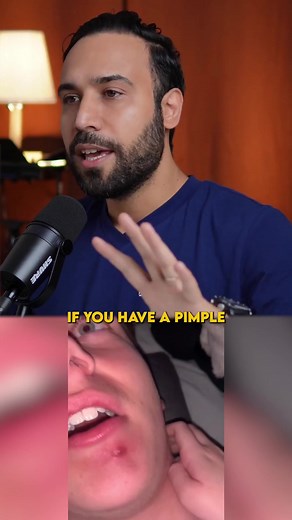 The Dangers of Popping Pimples: Skincare Tips