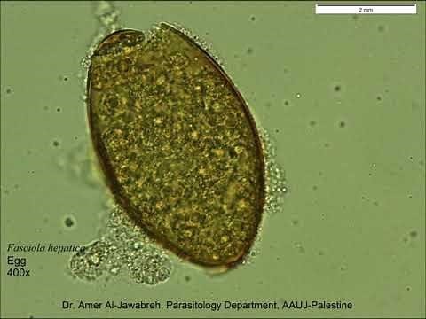 Fasciola hepatica egg