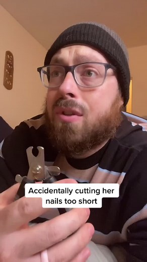 Dealing with Accidentally Cutting Dog's Nails Too Short