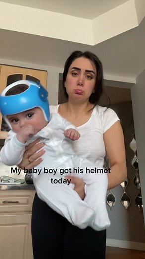 Did any of your kids have to wear a helmet?😭