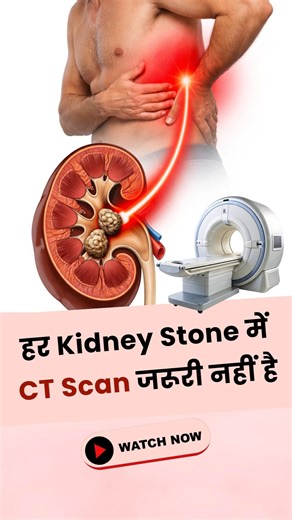 क्या Kidney Stone में CT Scan जरूरी है? Ultrasound vs CT scan explained by Dr Divya
