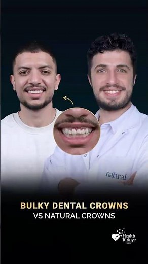 Dental Crowns Before & After: Replacing Bulky Old Crowns + Gingivectomy
