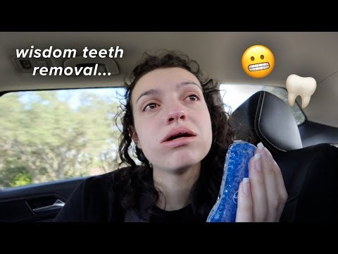GETTING MY WISDOM TEETH REMOVED *hilarious vlog*