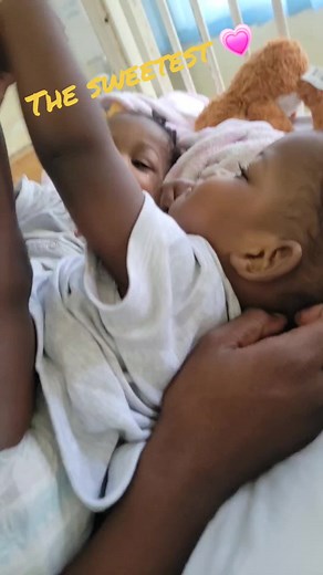 Heartwarming Journey of Conjoined Twins Tobi and Ubi
