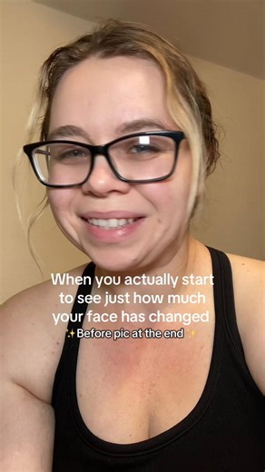 Transforming My Health Journey: A Before & After Story