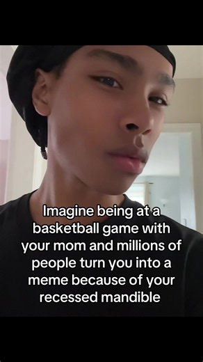 Chopped chin #viralvideotiktok #lm #bp #choppedchin #recessed | basketball with mom chin