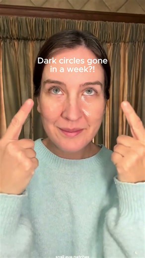 Dark circles visibly reduced in a week when you are consistent with the right treatment...