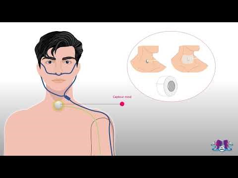 Comment installer les capteurs pour un test du sommeil (polygraphie)