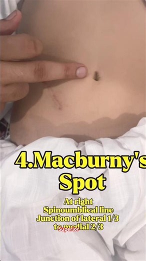 Master Abdominal Palpation