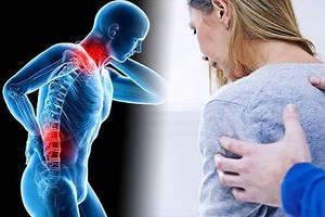 Fibromyalgia: where are the tender points that cause pain on palpation?