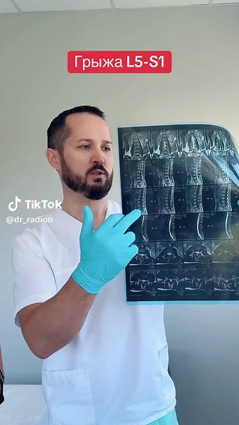 Understanding and Treating L5-S1 Disc Herniation with Doctor Radion