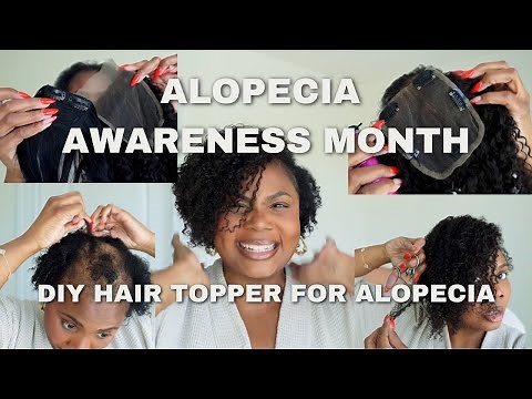 *Very Detailed* HOW TO MAKE A HAIR TOPPER FOR ALOPECIA