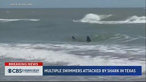 The 4th of July holiday turned into a nightmare for one beachgoer who was bitten in the leg by a shark while swimming in the waters around South Padre Island, Texas. | CBS Evening News