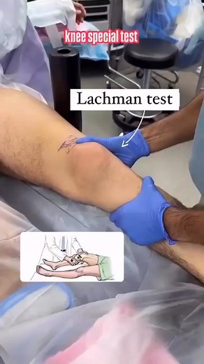 Knee special test.🩺💪🩺❤️🫰 🔖🔖🔖🔖Special tests for the knee joint are used in physiotherapy and orthopedics to assess the integrity of specific structures like ligaments, menisci, and patellofemoral joint. Here’s a list of common knee joint special tests categorized by structure ❤️🩺1. Ligamentous Tests: Anterior Cruciate Ligament (ACL): Lachman Test – Most sensitive for ACL injury. Anterior Drawer Test – Checks ACL integrity. Pivot Shift Test – Detects anterolateral rotary instability. Post