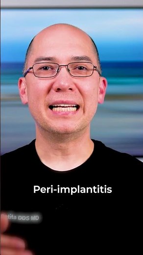 Bone Loss Around Implants Is Silent Until It's Already Too Late