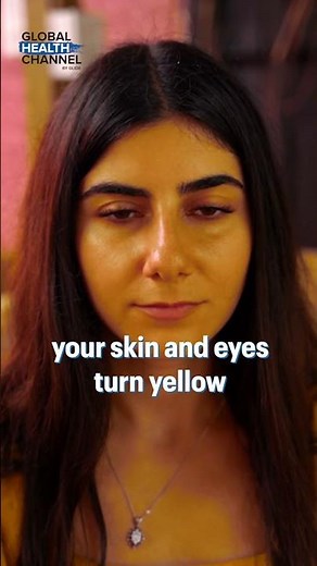 7 signs of Yellow Fever!