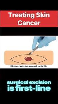 NCCN Skin Cancer Treatment Guidelines: Surgical Excision and Alternative Therapies