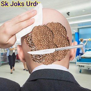 18K views · 94 reactions | How to back side Head ️ Boy surgery Animation 2d | SK Joks Urdu | Facebook