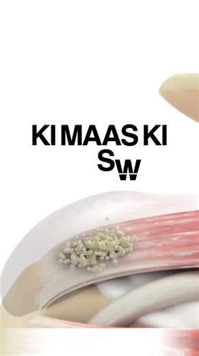 say bye to Shoulder Pain with PRP Treatment | Role of PRP injection in shoulder injuries recovery