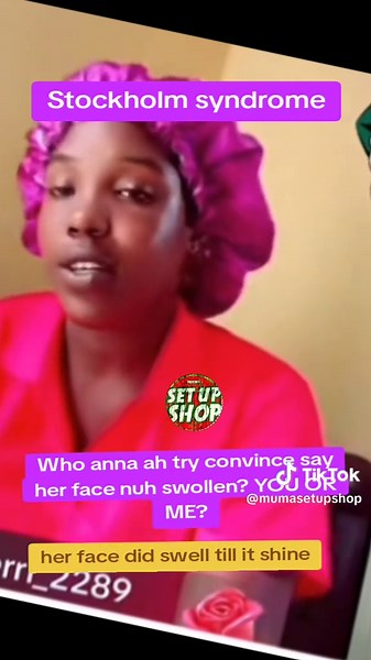 Anna's Dramatic Face Change Explained