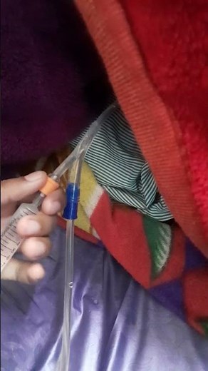 #How to Foley catheter remove#