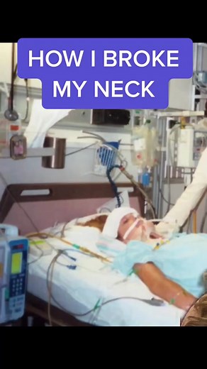 Here’s my story of how I broke my neck 💕 #disabilitytiktok #disability #wheelchair #wheelchairdontcare #fyp #foryourpag #foryou #disabilityawareness #spinalcordinjury #blessedlife #moveyourmind #wheelchairwoman #stronger #motivation #greenscreen