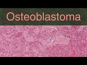 Osteoblastoma - Pathology mini tutorials