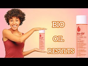 Bio-Oil Review: Real Results on Scars, Stretch Marks & Glowing Skin
