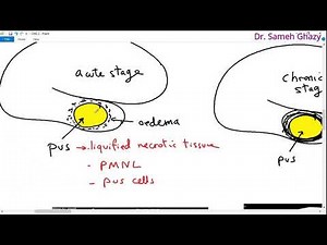 Systemic pathology 18 : CNS 2 (brain abscess and degenerations ) DR.SAMEH GHAZY