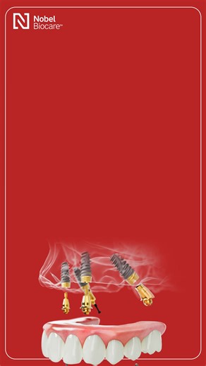 Tooth loss doesn’t just affect how you eat or speak — it can change how you feel about showing up in the world. The All-on-4® Treatment Concept offers more than a functional solution. It brings back expression, structure, and confidence in one streamlined approach. Rediscover what a complete smile can do, with Nobel Biocare’s All-on-4® solution. #NobelBiocare #AllOn4 #SmileRestoration #FullArchSolution #ToothLossSupport #RestoreConfidence #CompleteSmile | Nobel Biocare | Facebook