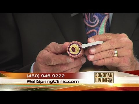 Clear your arteries naturally and safely