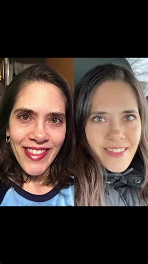 🌱 Before ➡️ After Real people. Real results. Real food. These powerful transformations highlight what’s possible with Purium’s regeneratively grown organic nutrition program—supporting the body at the cellular level and allowing it to do what it was designed to do. 💚 ✨ Curious how this works? 👉 Comment ULT for more information and details on how to get started! #phpbeforeandafter 🌱 Antes ➡️ Después Personas reales. Resultados reales. Comida real. Estas poderosas transformaciones demuestran l