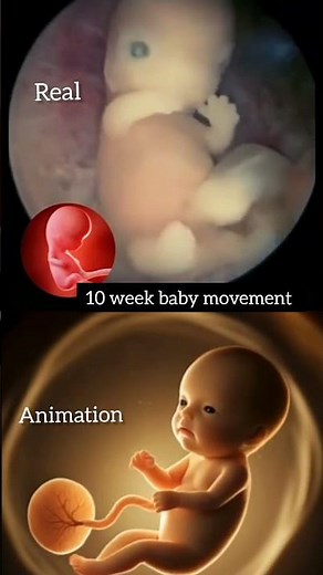 10 week baby movement in mother womb , real vs animation