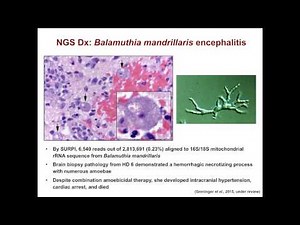 Charles Chiu - Next Generation Sequencing for Diagnosis and Surveillance of Emerging Infections