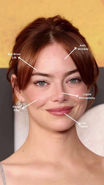Emma Stone: A Look at Her Transformative Treatments