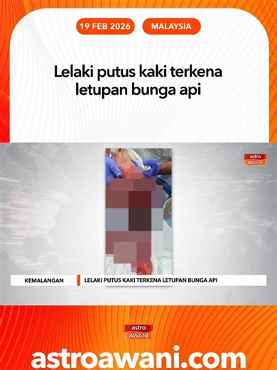 Kecederaan Parah Akibat Letupan Bunga Api di Segamat