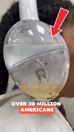 1.5K views · 12 reactions | Smart Ear Cleaning Device Millions struggle with hearing loss from earwax buildup. This innovative device uses gentle irrigation and advanced micro-suction to clear blocked ears safely and effectively. A modern healthcare solution for better hearing and comfort. Credits : @tryotoset, /YT #HearingSolutions #HealthInnovation #medicaldevices #medical #trendingvideo | Bee Force News | Facebook