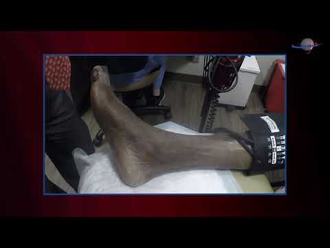 WCW: Using Doppler Signal to Examine Blood Flow