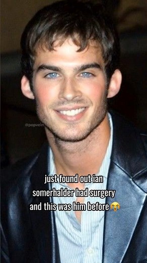 just found out ian somerhalder had surgery and this was him before 😭