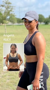 20K views · 103 reactions | When your surgeon understands the...