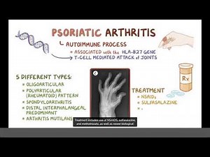 Psoriatic Arthritis- Causes, Symptoms, Diagnosis & Treatment (Pathology)