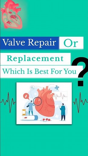 Heart Valve Repair vs Replacement | Dr. Amit Chandan Explains in Simple Words