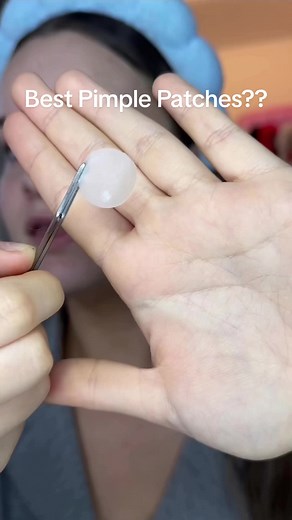 Say Goodbye to Pimples Overnight with Skin Control Pimple Patches