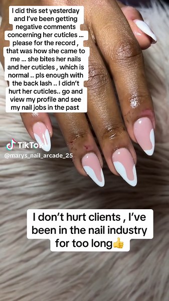 Nail Care Insights: Addressing Nail Biting Concerns