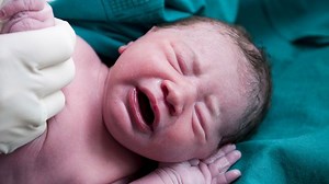 To snip or not to snip: Pediatric Society updates advice on circumcision