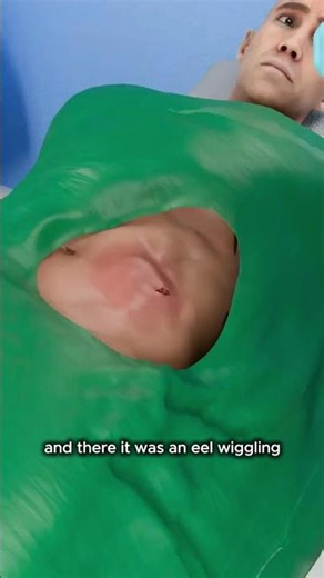 Doctors Found Something ALIVE Inside a Man’s Stomach 😱🐍 You Won’t Believe What It Was!