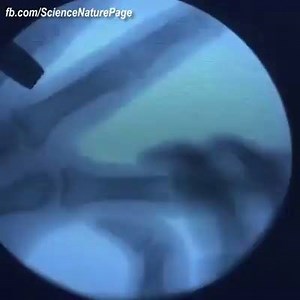55K views · 614 reactions | What happens when you crack your joints? | I Love Anatomy | Facebook