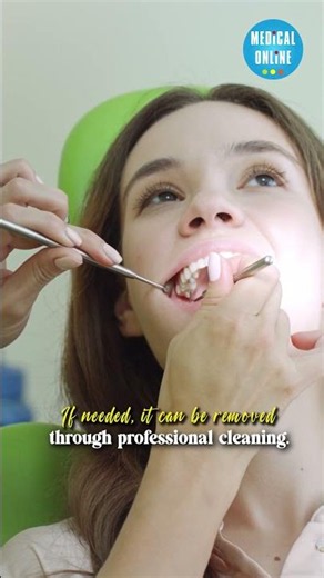 Are Black Stains on Teeth Cavities or Just Stains? #healthtips #toothdecay #dentalcare #oralhealt...