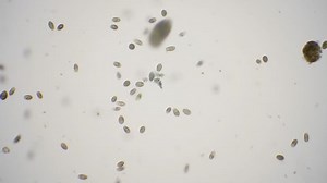 Pond life under the microscope in 4k