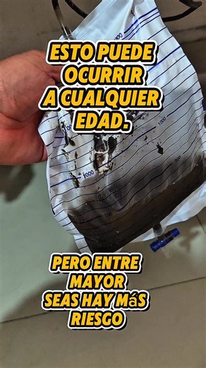 Hemorragia digestiva alta #doctorhumano | Dr. Zamora en VIVO